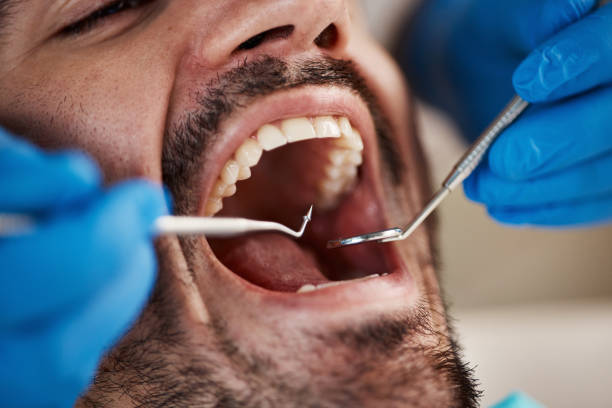 Best Emergency Cosmetic Dentistry in Elmira, NY